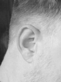 Ear 4