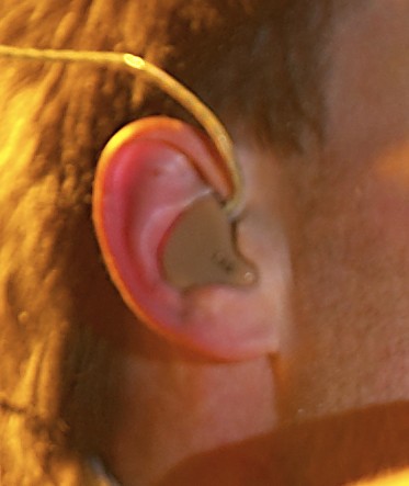 Ear 4